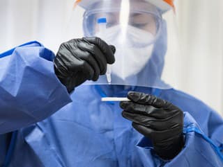 Počet hospitalizovaných s KORONAVÍRUSOM