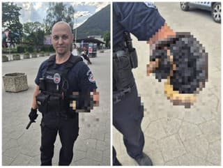 Cestujúci chytali infarktové stavy: