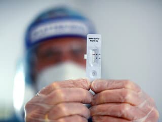 Viaceré inštitúcie ponúkajú možnosť testovania na HIV či hepatitídu